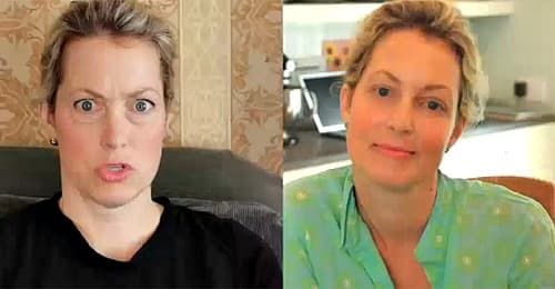 Ali Wentworth Plastic Surgery Before And After 1