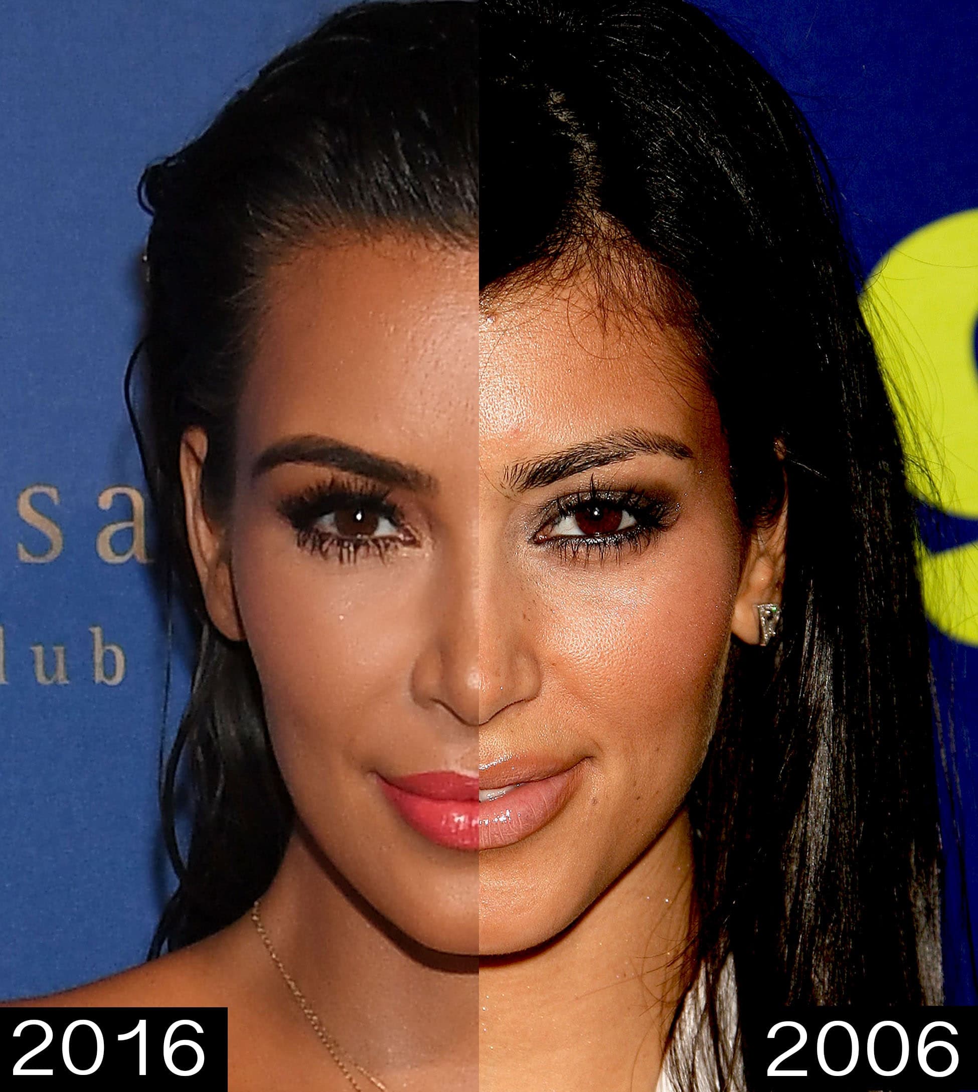 Before And After Kardashians Plastic Surgery 1