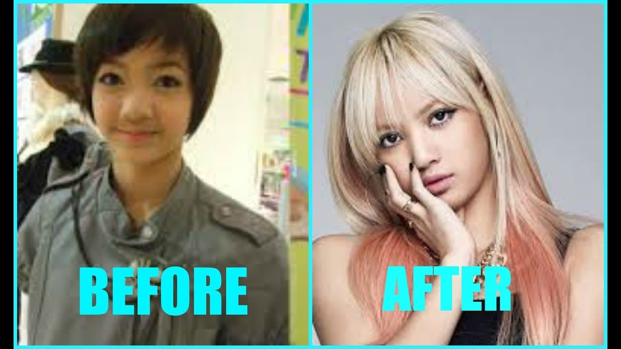 Before And After Kpop Plastic Surgery 1