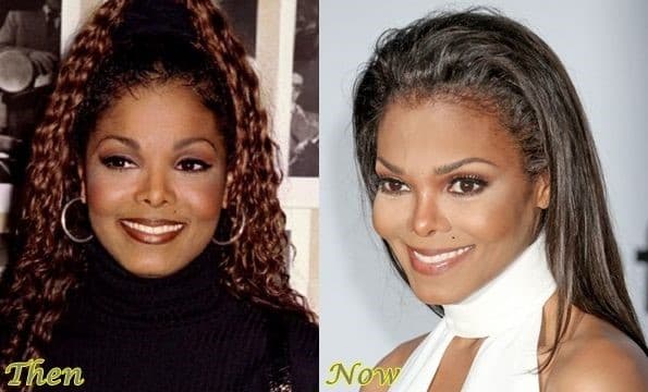 Janet Jackson Before After Plastic Surgery 1