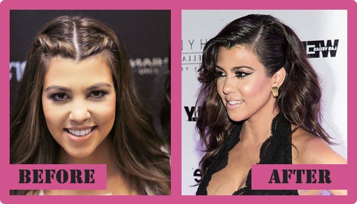 Kourtney Kardashian Plastic Surgery Before And After 1