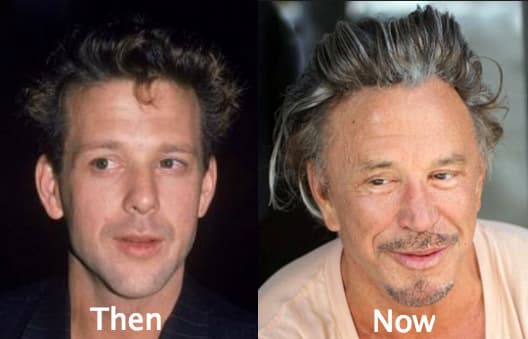 Mickey Rourke Photos Before Plastic Surgery 1