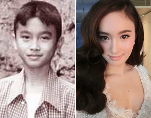 Nong Poy Before Plastic Surgery 1