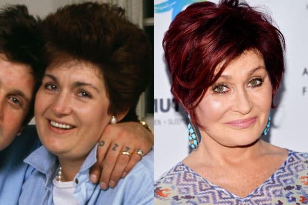 Old Images Of Sharon Osbourne Before Plastic Surgery 1