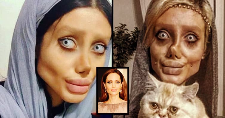 Angelina Jolie Plastic Surgery Fan Before 1