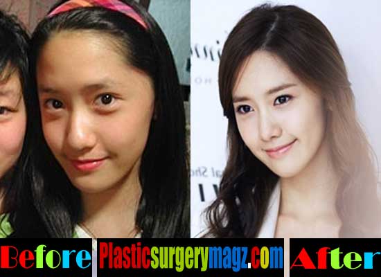 Before And After Korean Plastic Surgery Idols 1