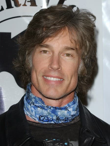 Before And After Plastic Surgery Photo Of Ron Moss 1