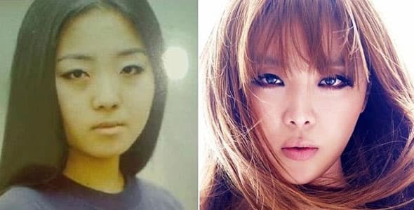 Brown Eyed Girls Before And After Plastic Surgery 1
