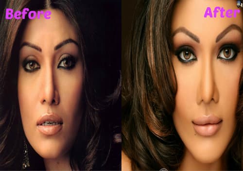Celebs Bad Before And After Plastic Surgery 1
