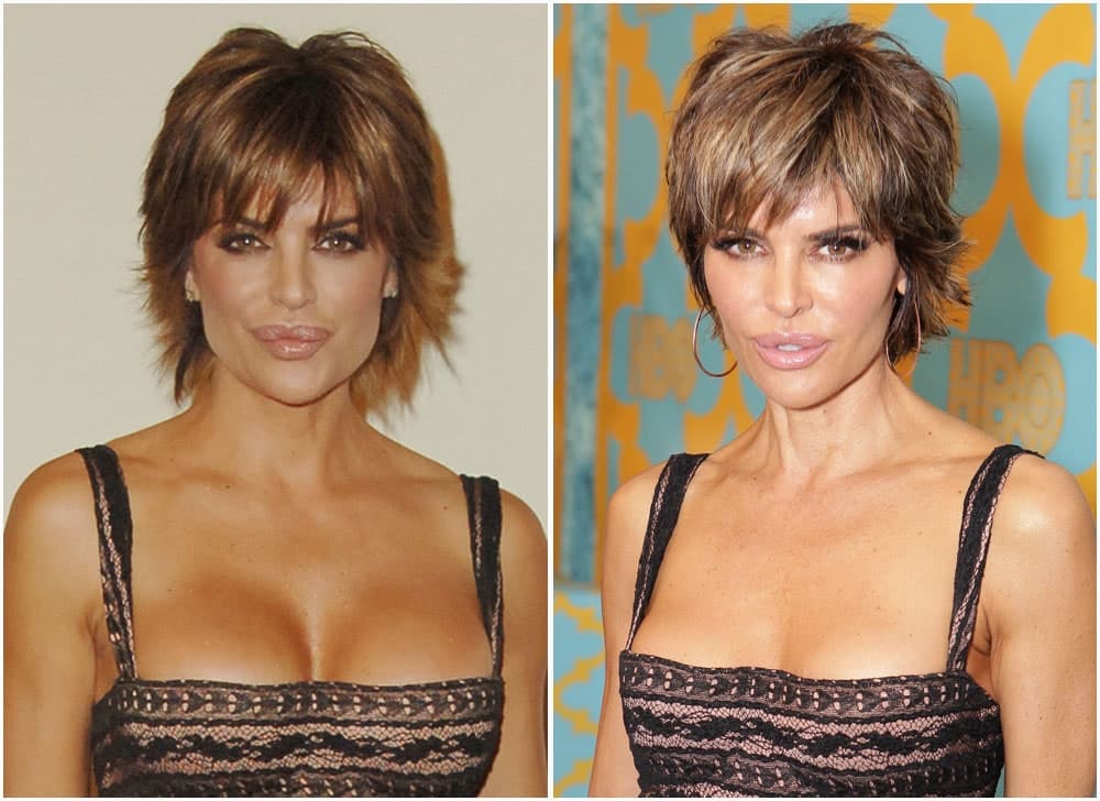 Did Lisa Rinna Have Plastic Surgery Before She Was Famous 1