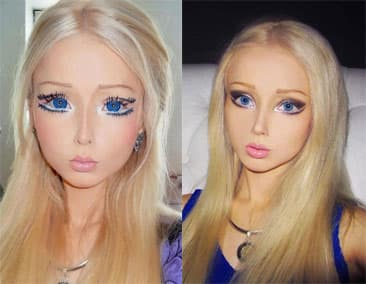 Extreme Korean Plastic Surgery Before And After 1