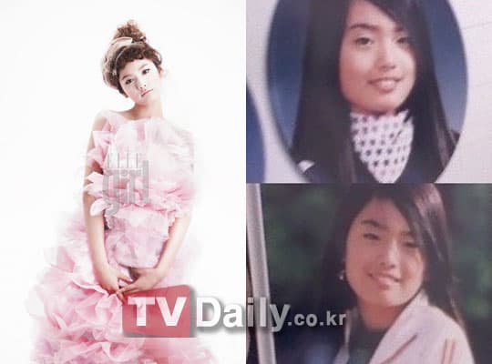 Gna Before And After Plastic Surgery 1