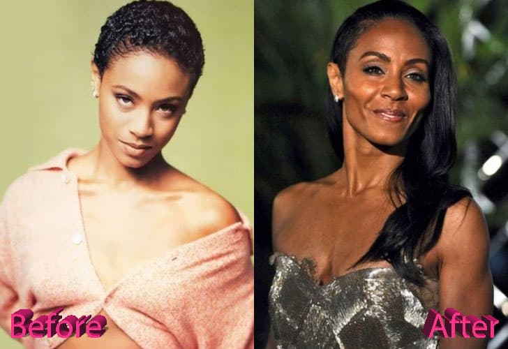 Jada Pinkett Plastic Surgery Before And After 1