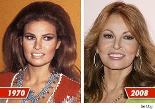 Jeanine Ferris Pirro Before And After Plastic Surgery 1