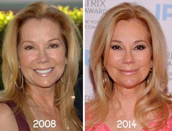 Jennifer Coolidge Before And After Plastic Surgery 1