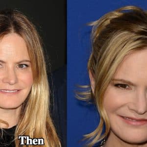 Jennifer Jason Leigh Before And After Plastic Surgery 1