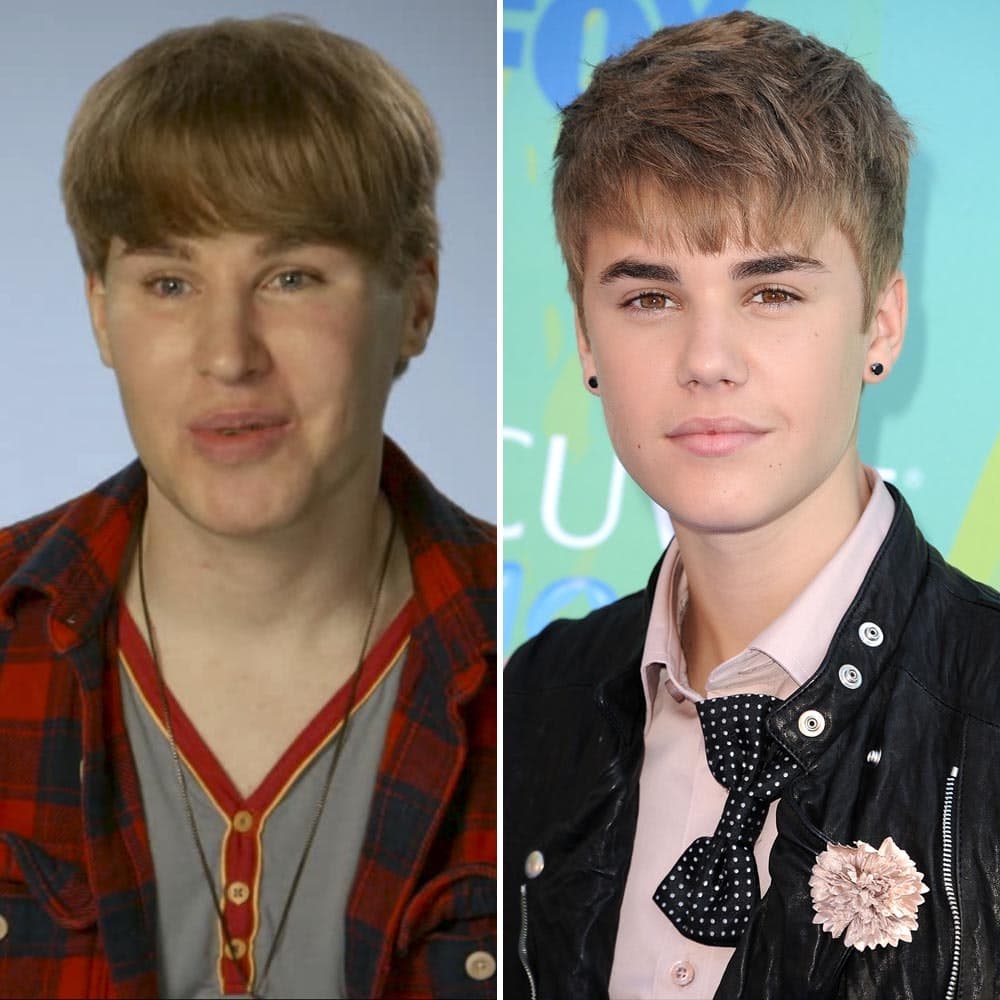 Justin Beiber Before Plastic Surgery 1