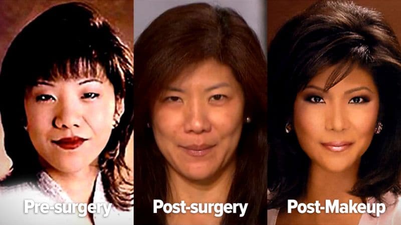 Lisa Ling Face Before And After Plastic Surgery 1