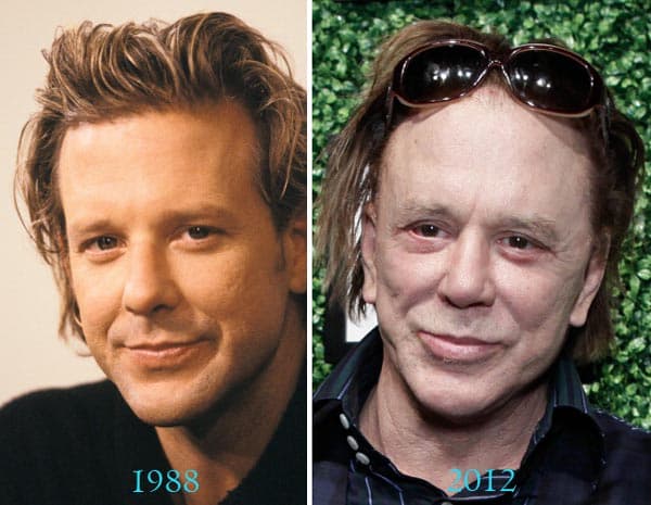 Mickey Rourke Plastic Surgery Before And After Pictures 1