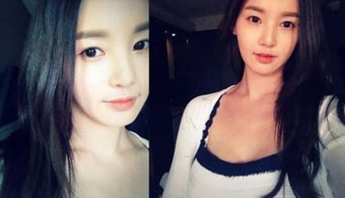 Nam Gyuri Plastic Surgery Before And After 1