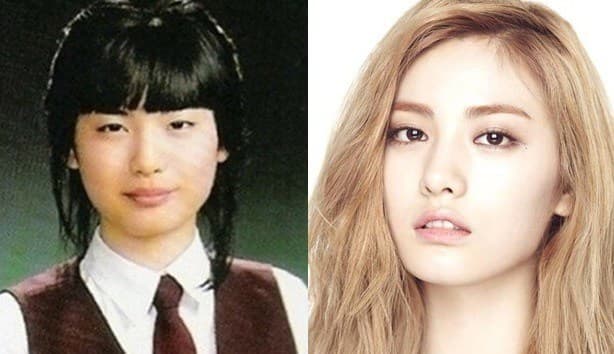 Nana Korean Singer Before And After Plastic Surgery 1