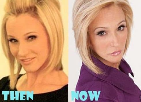 Paula White Plastic Surgery Before After Photos 2017 1