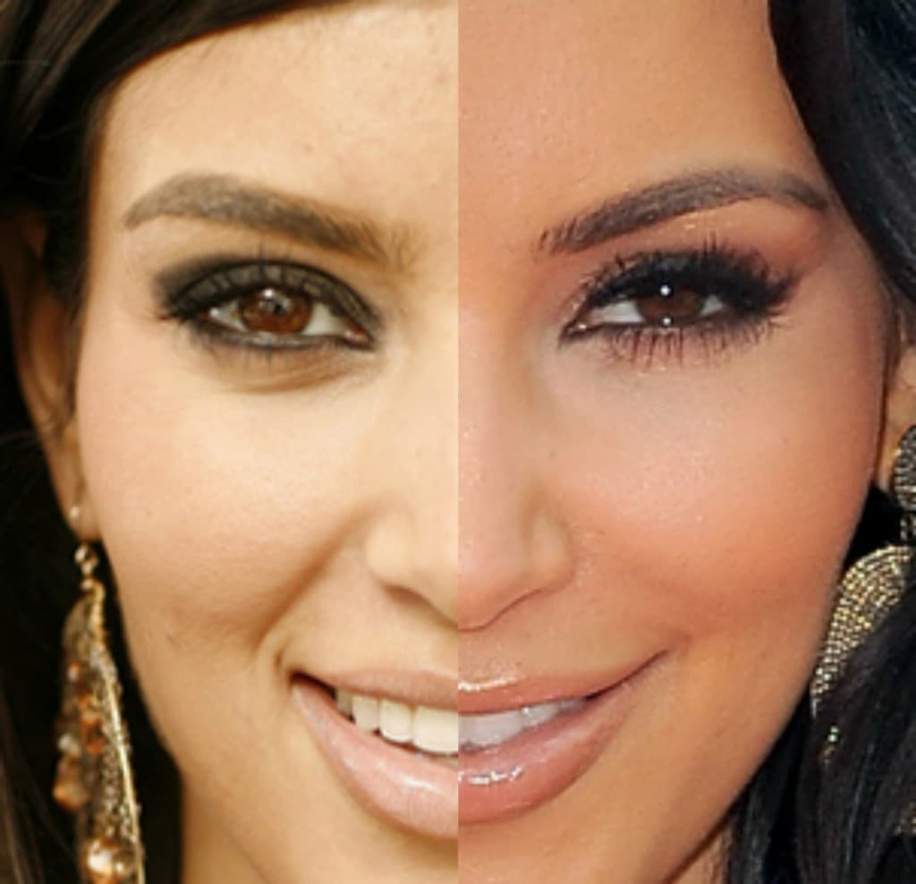 Plastic Surgery Before And After Kim Kardashian 1