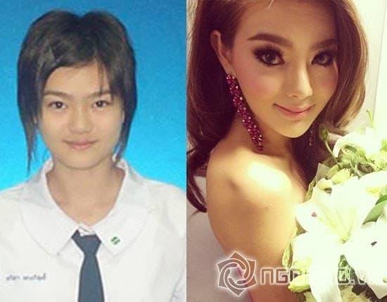 Thai Actress Before And After Plastic Surgery 1