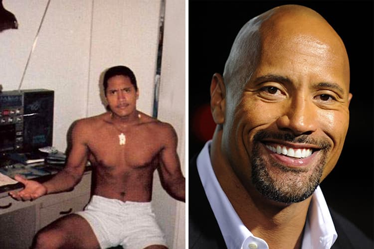 The Rock Plastic Surgery Before And After 1