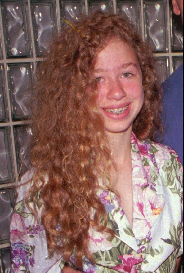 Young Chelsea Clinton Before And After Plastic Surgery 1
