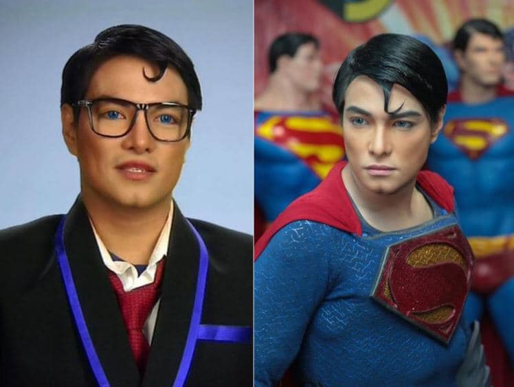 Clark Kent Plastic Surgery Before And After 1