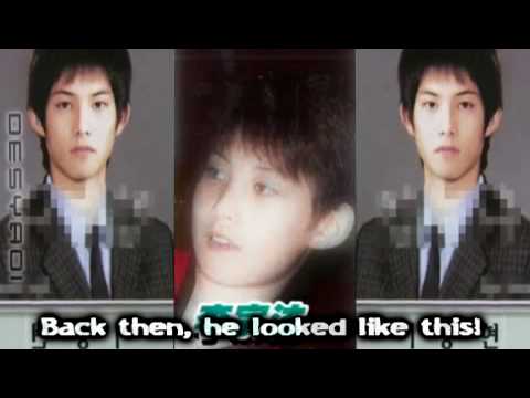 Cnblue Before And After Plastic Surgery 1