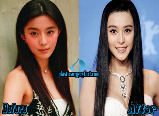 Fan Bingbing Before And After Plastic Surgery 1