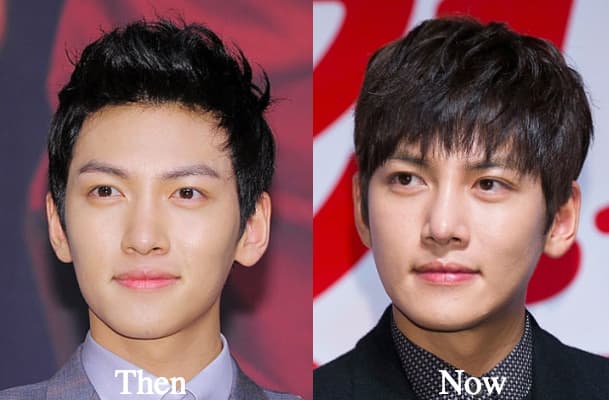 Ji Chang Wook Plastic Surgery Before After 1
