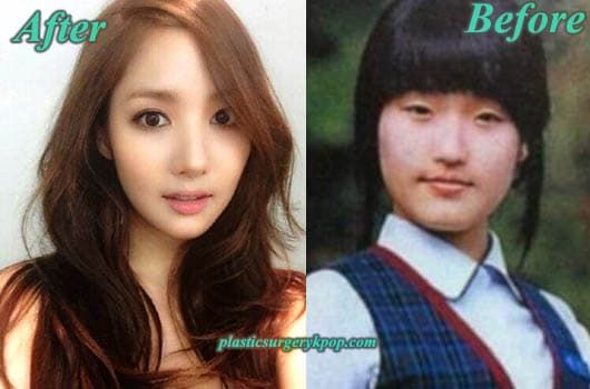 Jung So Min Before And After Plastic Surgery 1