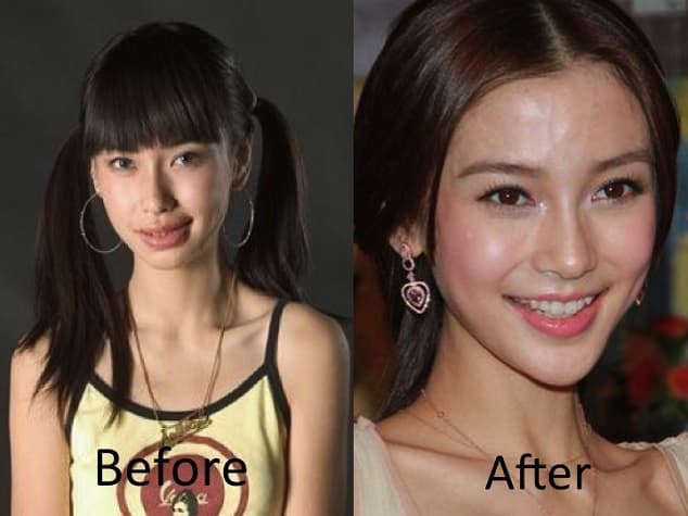 Angelababy Plastic Surgery Before And After photo - 1