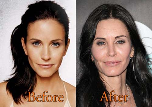 Courteney Cox Before And After Plastic Surgery Photos photo - 1