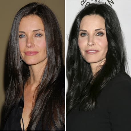 Courtney Cox Plastic Surgery Before After photo - 1