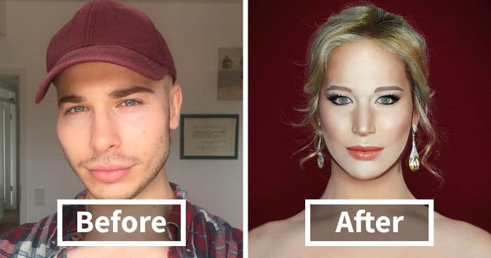 Drag Queen Plastic Surgery Before And After photo - 1