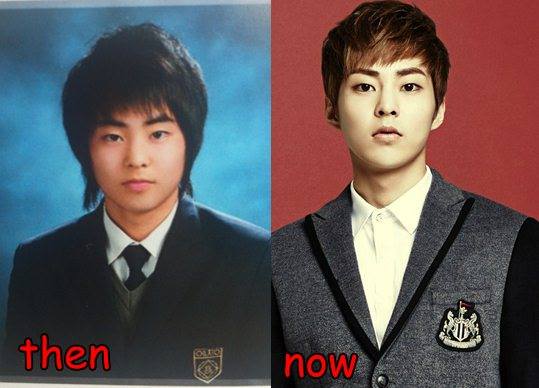 Exo D.O Plastic Surgery Before And After photo - 1