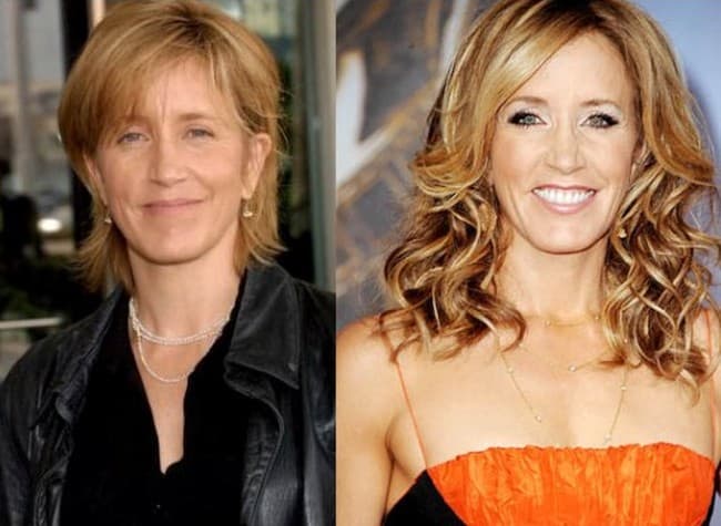 Felicity Huffman Surgery Before And After photo - 1