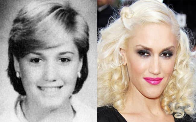 Gwen Stefani Plastic Surgery Before After photo - 1