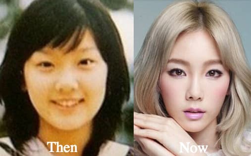 Ha Yeon Soo Plastic Surgery Before And After photo - 1