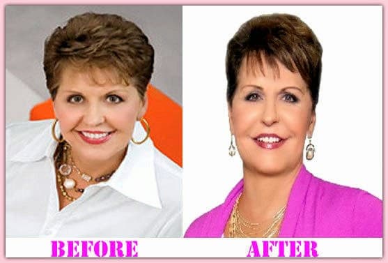 Joyce Meyer Before And After Plastic Surgery photo - 1