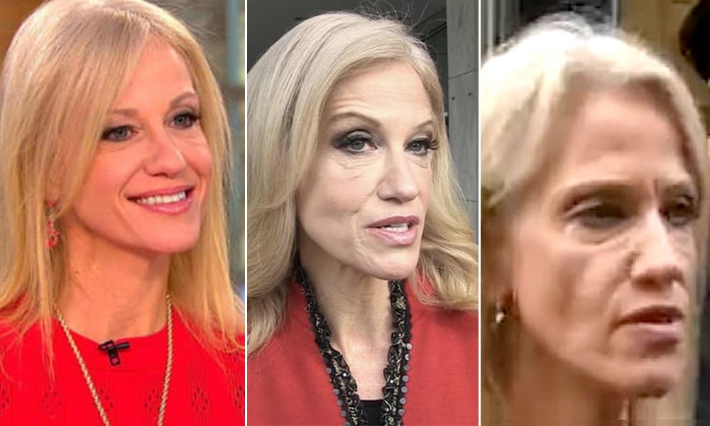 Kellyanne Conway Plastic Surgery Before After photo - 1