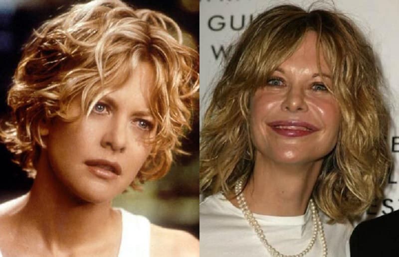 Meg Ryan Before And After Plastic Surgery photo - 1