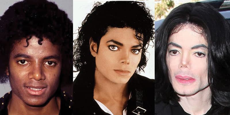Michael Jackson Plastic Surgery Before After photo - 1