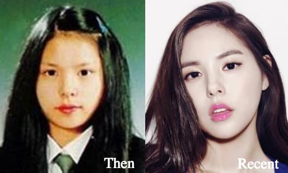 Min Hyo Rin Before And After Plastic Surgery photo - 1