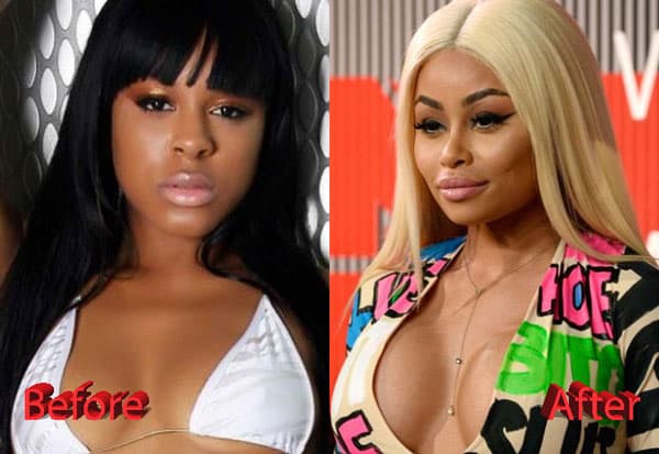 Pic Of Blac Chyna Before Plastic Surgery photo - 1