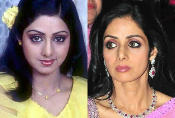 Plastic Surgery Before And After Indian Actress photo - 1